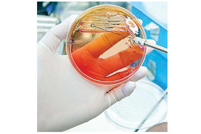 Petri Dishes Petri Dishes