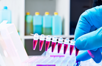 PCR (DNA Amplification) PCR (DNA Amplification)